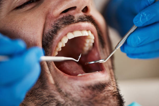 Best Orthodontic Emergency Dentist in Green Level, NC